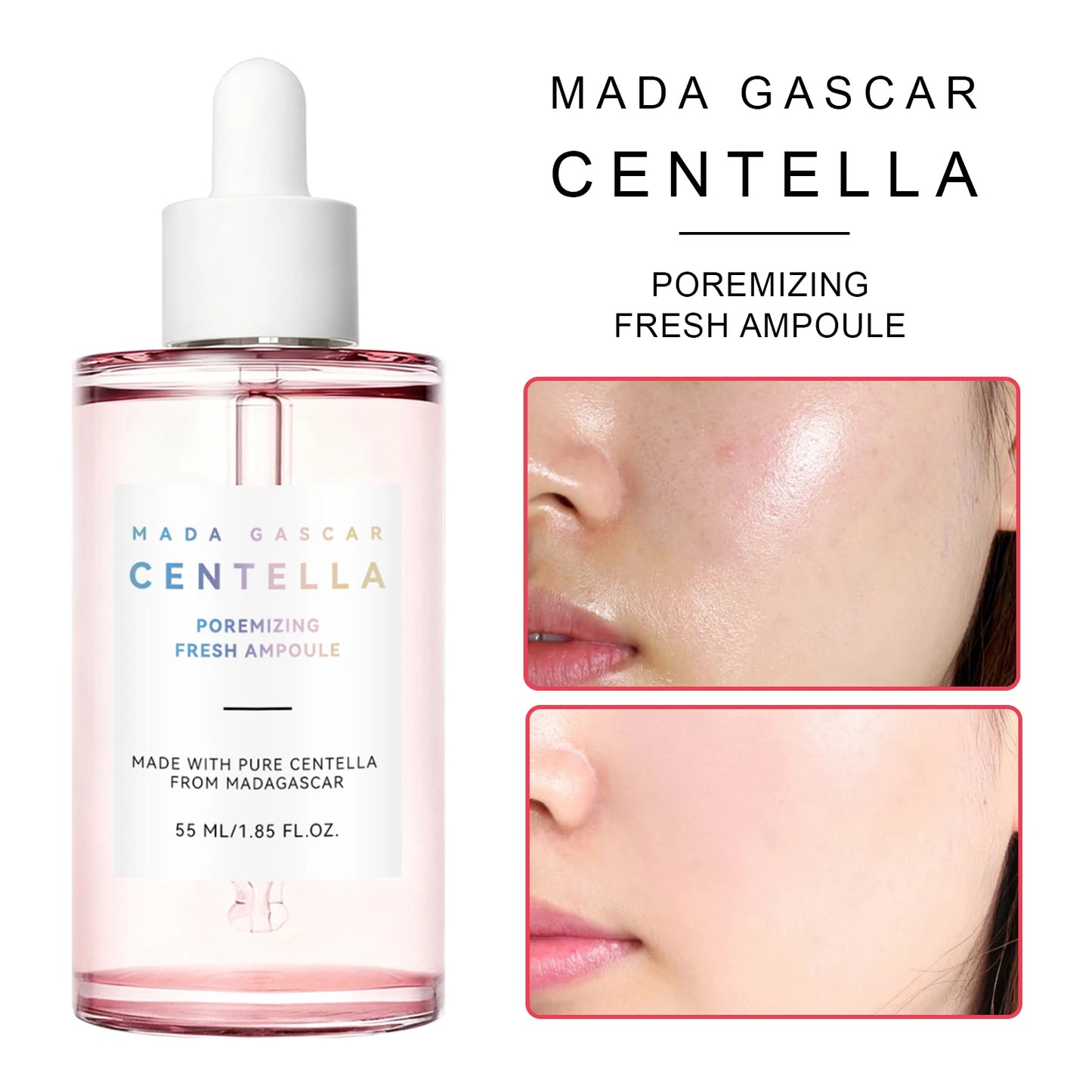 Madagascar Gotu Kola Essence 55ml - Calming Serum